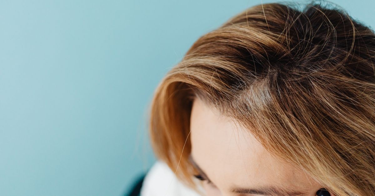 Adieu aux pellicules sèches : les solutions simples et efficaces pour un cuir chevelu apaisé
