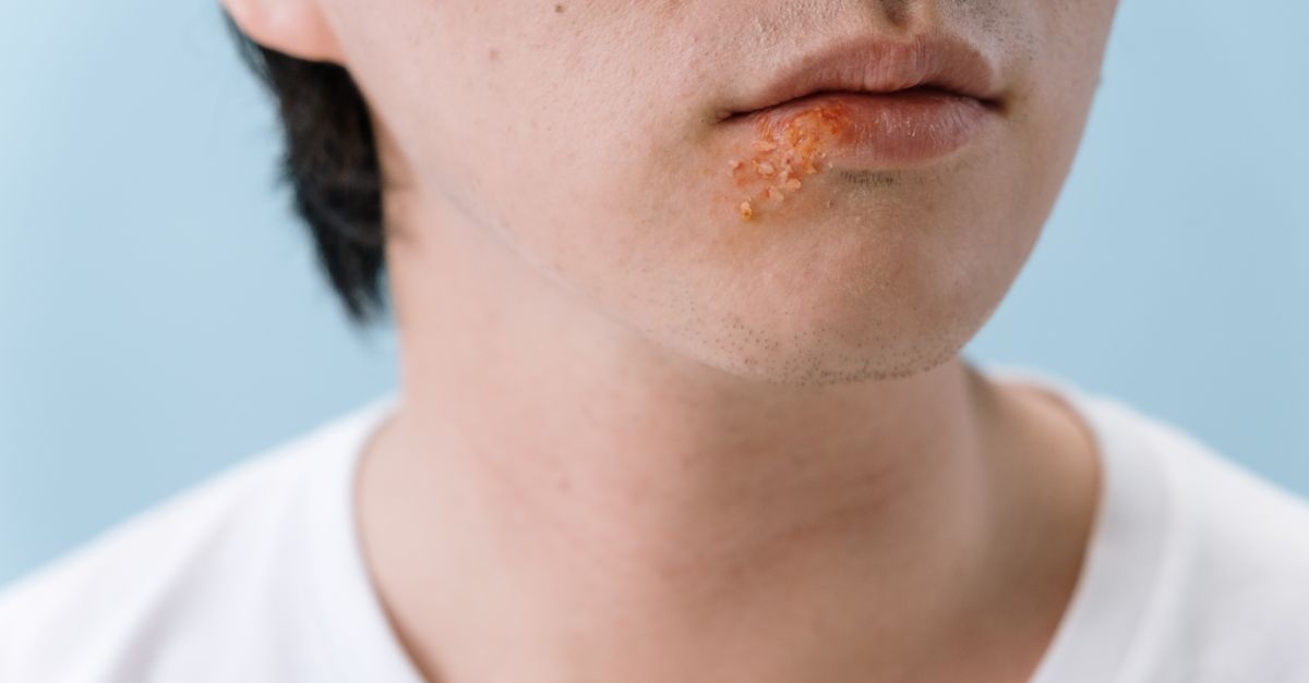 Quand le stress s’invite sur la peau : comprendre et apaiser le psoriasis